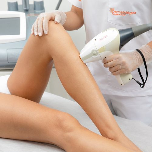 Depilacion Laser Media Pierna x 8 sesiones