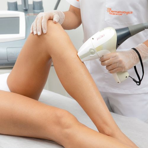 Depilación láser media pierna femenina