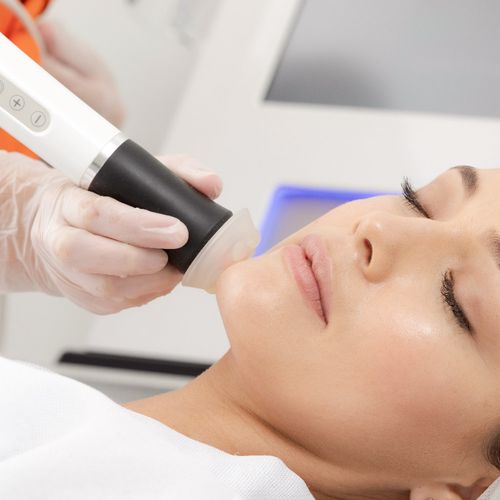 Super Facial Rionegro