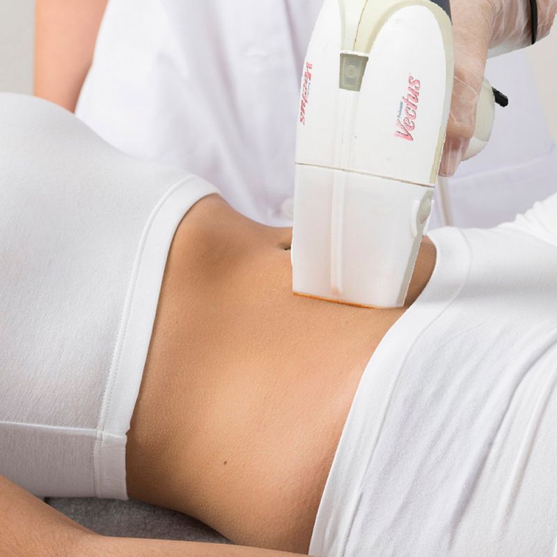 depilacion-abdomen-fem