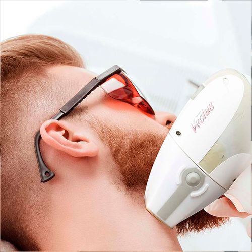 Depilación Láser Barba