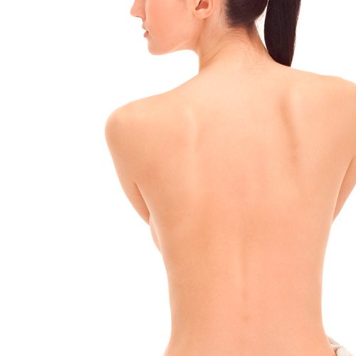 Depilación láser espalda femenina
