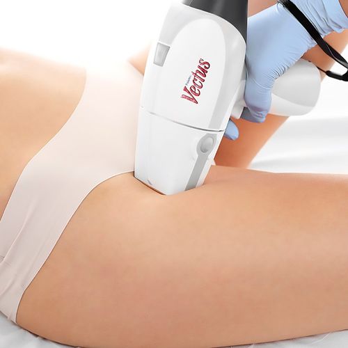 Depilación Laser Bikini x 8 sesiones