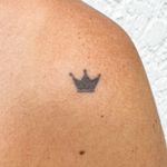 Eliminacion-de-Tatuaje-Mini-1