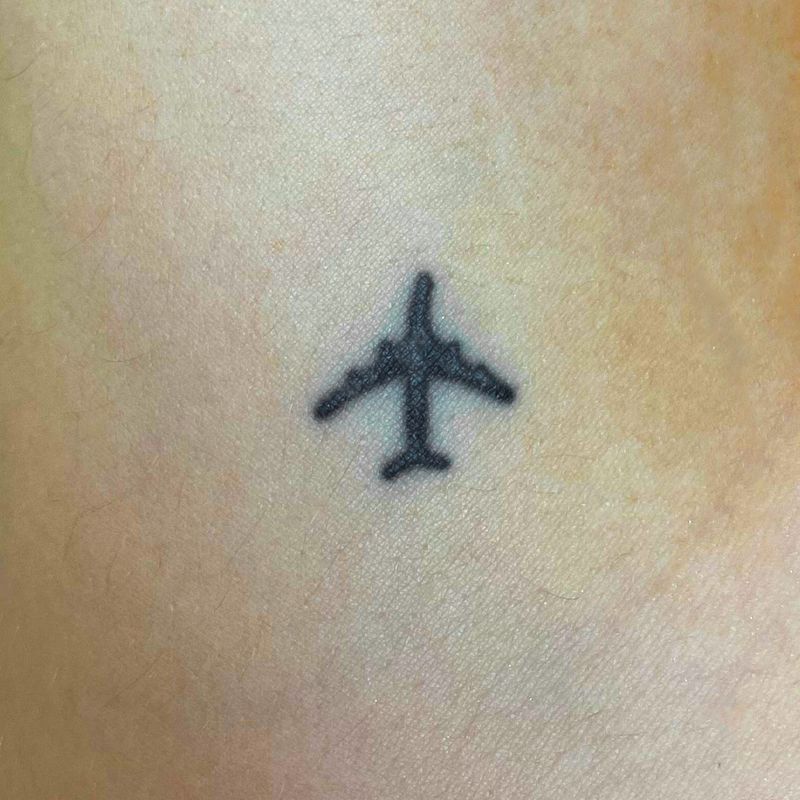Eliminacion-de-Tatuaje-Mini-2