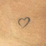 Eliminacion-de-Tatuaje-Mini-3