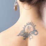Eliminacion-de-Tatuaje-Mediano-3
