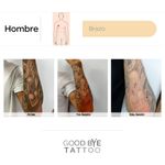 Eliminacion-de-Tatuaje-8