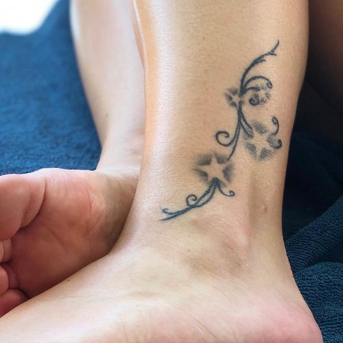 Eliminación de tatuaje grande 6 sesiones