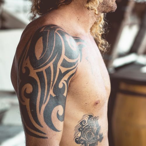 Eliminación de tatuaje brazo 3 sesiones