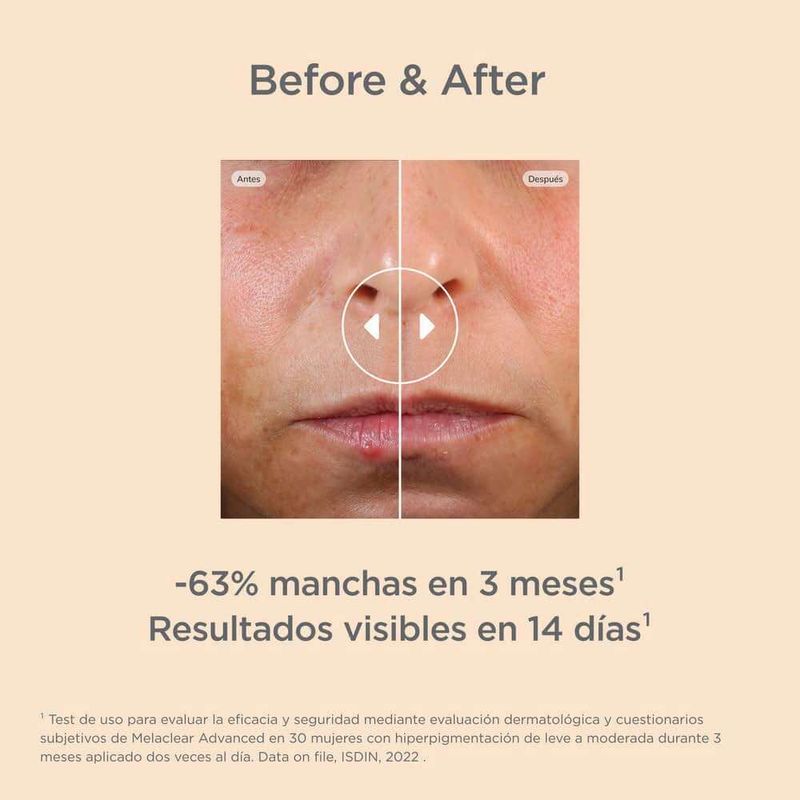 MELACLEAR-ADVANCED-2