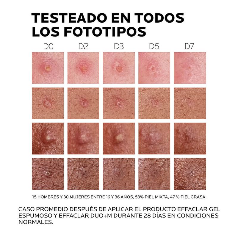 Effaclar-Duo---M-Gel-X-40-Ml-5