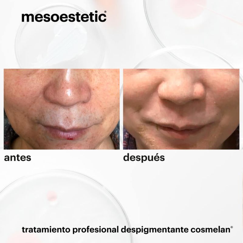 Cosmelan-2-X-30-G-4.jpg