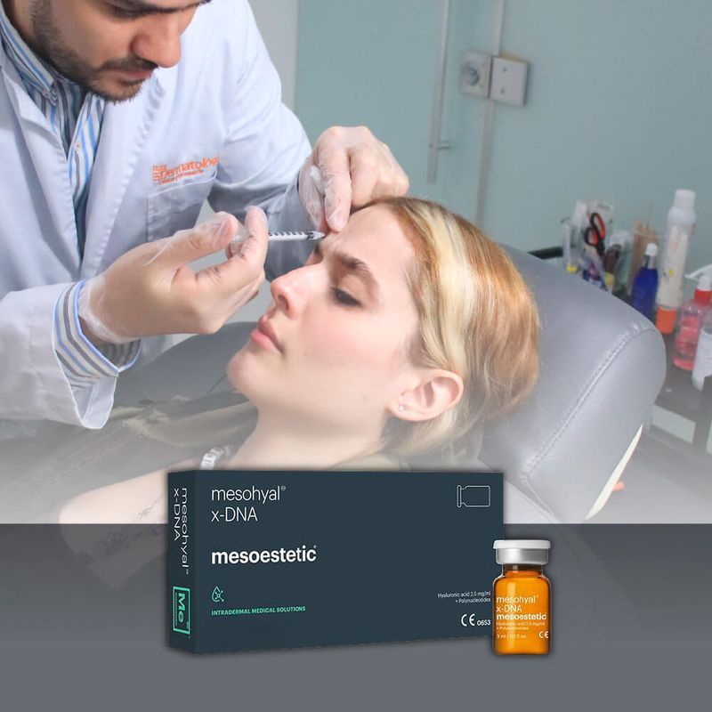 mesohyal-x-DNA-esperma-de-salmon-1.jpg