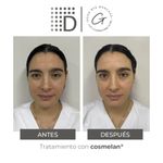 Cosmelan Home Pack-4
