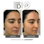 Cosmelan Home Pack-3