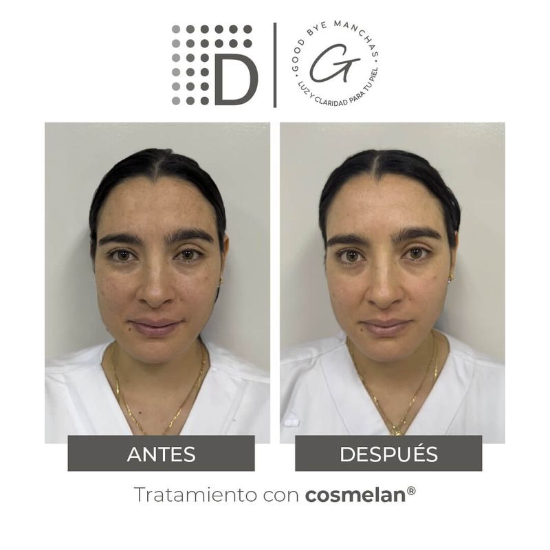 Cosmelan 2 X 30 G-
