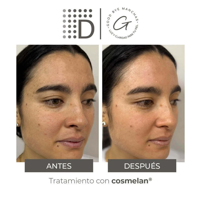 Cosmelan 2 X 30 G- -1-