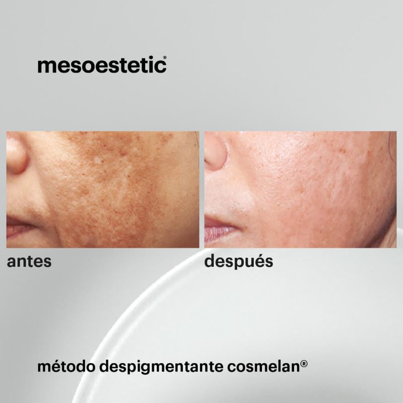 Cosmelan-2-X-30-G-3.jpg