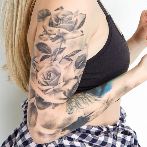 Eliminación de tatuaje brazo 3 sesiones